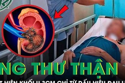 Người đàn ông 45 tuổi tá hỏa phát hiện mắc ung thư thận từ dấu hiệu đau lưng