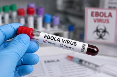 Bác sĩ Bạch Mai chỉ ra quy tắc '2 - 5 - 30' trong ngăn chặn Ebola