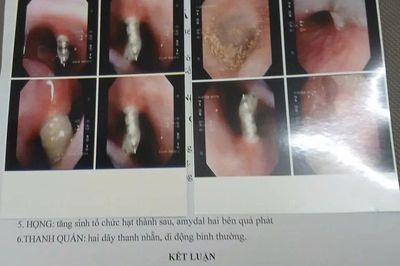 Vụ niềng răng bị thủng xoang mũi: Lập hội đồng chuyên môn rà soát quy trình
