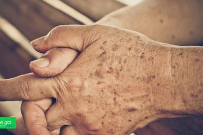 Báo động làn da tuổi già: Những thay đổi sinh lý đáng lo!