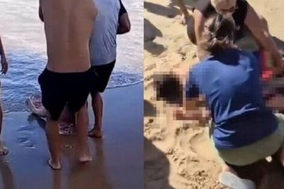 Rùng mình khoảnh khắc cô gái 19 tuổi ở Brazil bị cá mập tấn công, đứt chân phải khi đang tắm biển