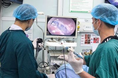 Cứ nghĩ bị trĩ, người phụ nữ bất ngờ phát hiện khối polyp lớn trong trực tràng