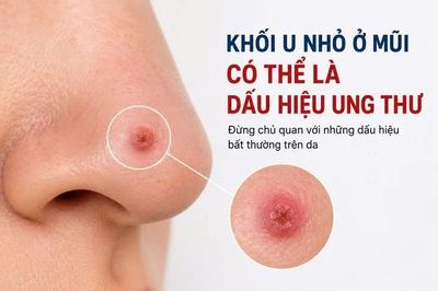 Phát hiện sớm ung thư da từ mụn nhỏ trên mũi