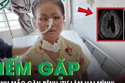 Nữ sinh 19 tuổi mắc căn bệnh 'tự làm hại mình' hiếm gặp