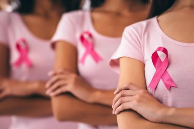 Bước tiến mới trong điều trị ung thư vú: Không cần hóa trị nhờ xét nghiệm ADN khối u