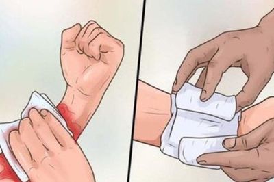 Đắp lá chữa vết thương, bệnh nhân tử vong vì uốn ván