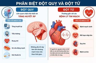 Phân biệt đột quỵ và đột tử trong những phút đầu sinh tử