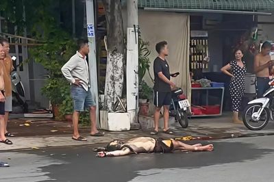 Nam thanh niên bỏng nặng nghi do phóng hỏa tiệm giặt sấy ở Cà Mau