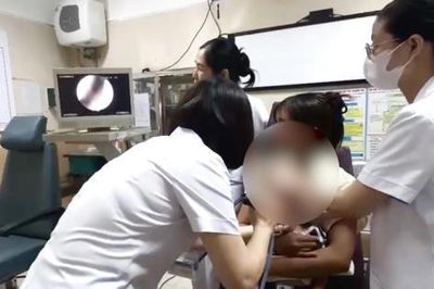 Bé gái 2 tuổi nhập viện do bọ chét ký sinh trong màng nhĩ