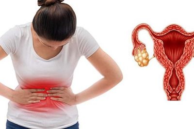 Người phụ nữ 25 tuổi mắc hội chứng buồng trứng đa nang vẫn sinh con khỏe mạnh nhờ làm điều này