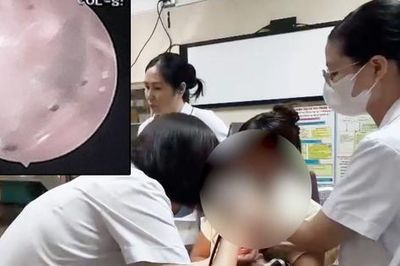 Thường xuyên chơi với thú cưng, bé gái 2 tuổi bị bọ chét ký sinh trong tai