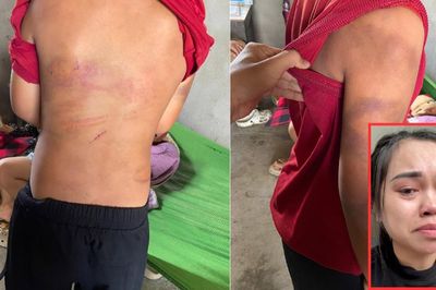 Nghệ An: Mẹ tố cha ruột bạo hành con trai 10 tuổi