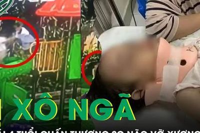 Bé gái 4 tuổi bị bạn xô ngã từ cầu trượt cao 1,5m chấn thương sọ não vỡ xương trán