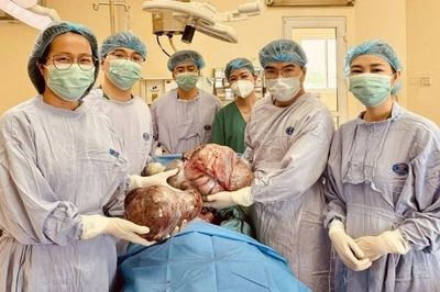 Phẫu thuật thành công cho nữ sinh mang hai khối u buồng trứng khổng lồ nặng gần 15kg