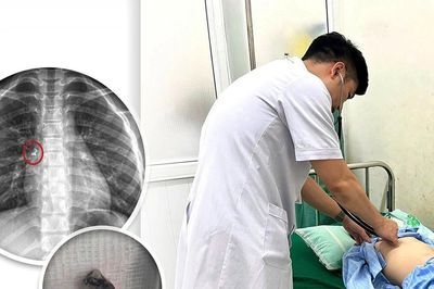 Được mẹ nhổ răng tại nhà, bé trai phải đi cấp cứu sau sự cố hi hữu