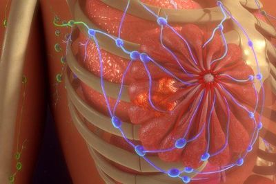 Công nghệ điều trị ung thư mới không cần dùng thuốc