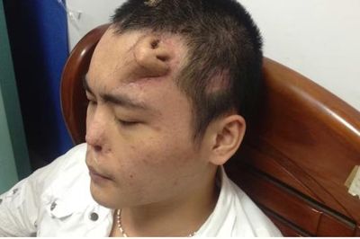 Người đàn ông có chiếc mũi 'mọc' giữa trán, sự thật phía sau gây bất ngờ