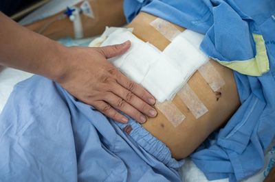 Loại ung thư đang trẻ hóa, bác sĩ cảnh báo nguy cơ ít người để ý