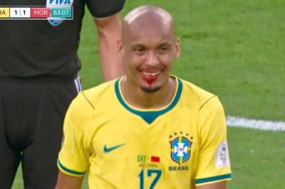 Nụ cười 'ma cà rồng' của cầu thủ Brazil viral khắp cõi mạng