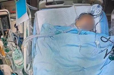 Người đàn ông 60 tuổi tử vong, bác sĩ nói ngay: Mùa hè thà ăn ít thịt cũng đừng quên 5 món 'vạn người mê' này
