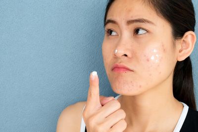 5 món skincare mang tiếng 'thần dược' nhưng nhiều chuyên gia làm đẹp khuyên nên dè chừng