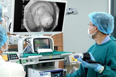 Đau bụng, người phụ nữ đi khám phát hiện tổn thương tiền ung thư ở vị trí khó ngờ