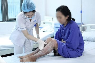 Thuốc sinh học mới giúp điều trị vảy nến kháng trị hiệu quả