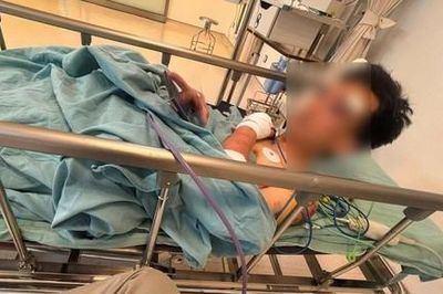 Công an xác minh vụ bảo vệ chung cư đánh người nghi từ mâu thuẫn phí gửi ôtô