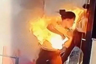 Cục sạc dự phòng phát nổ trong túi xách, cô gái bị bỏng nặng