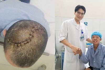 90 phút 'nghẹt thở' cứu người đàn ông bị vỡ lún sọ, tràn máu màng phổi