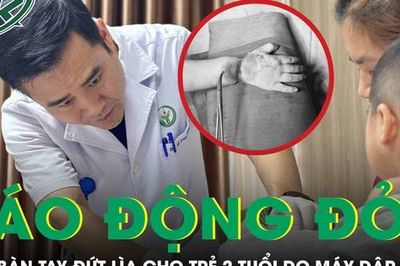 Báo động đỏ cứu bàn tay đứt lìa cho trẻ 2 tuổi bị máy dập cốc cuốn vào