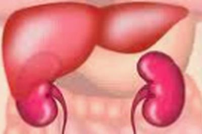 Nhận biết dấu hiệu bệnh trở nặng của xơ gan
