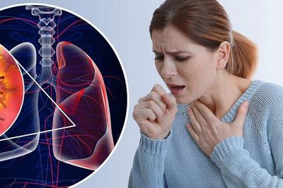 Ung thư phổi ở người không hút thuốc, hiểm họa tiềm ẩn từ môi trường sống