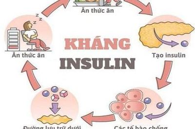 Omega-7 có giúp cải thiện đề kháng insulin và sức khỏe chuyển hóa?