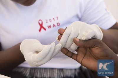 Liên hợp quốc kêu gọi đẩy nhanh tiến độ chấm dứt đại dịch AIDS toàn cầu