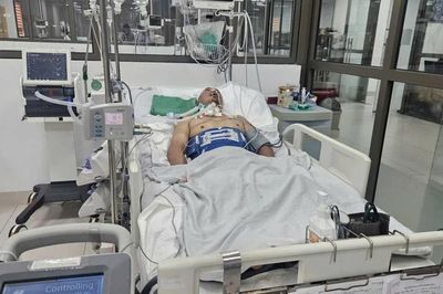Cứu nam công nhân bị tai nạn chấn thương sọ não nặng