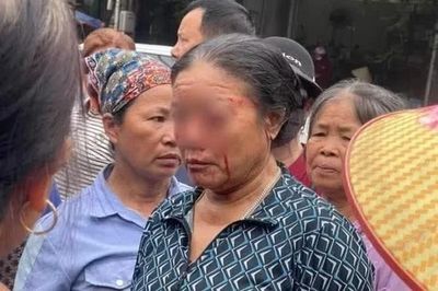 Cần xử lý nghiêm vụ xịt nước người bán rau ở Phú Thọ gây tổn thương mắt?