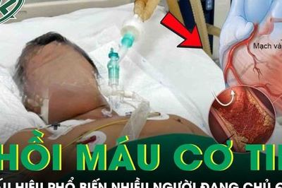 Người đàn ông 52 tuổi nhồi máu cơ tim vì dấu hiệu phổ biến nhiều người đang chủ quan