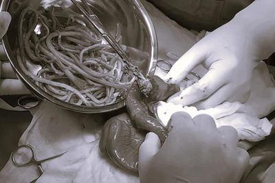 Dấu hiệu đến lúc cần xổ giun