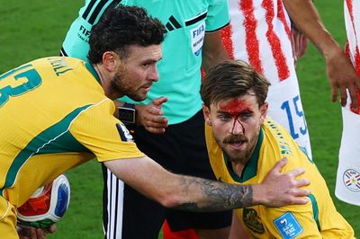 Rách mặt vẫn chiến đấu, Metcalfe khiến World Cup dậy sóng