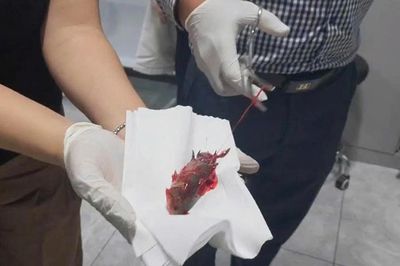 Hy hữu người đàn ông bị cá rô chui vào họng