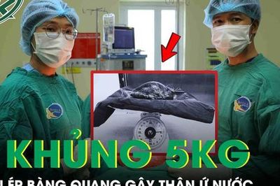 Người phụ nữ 53 tuổi mang khối u xơ tử cung khổng lồ nặng gần 5kg chèn ép bàng quang