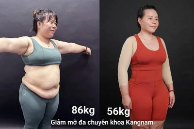100 ngày thoát mỡ an toàn: 'mẹ siêu nhân' hạnh phúc khi loại bỏ 30 kg mỡ