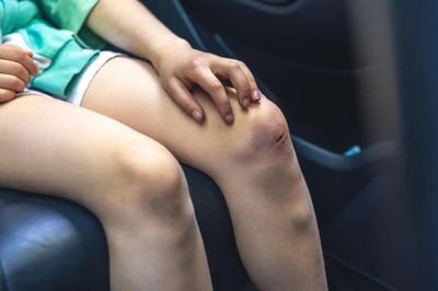 Dấu hiệu có thể là cảnh báo xơ gan giai đoạn đầu