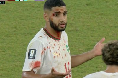 Hai cầu thủ đổ máu trong trận cầu thót tim giữa Hà Lan và Morocco
