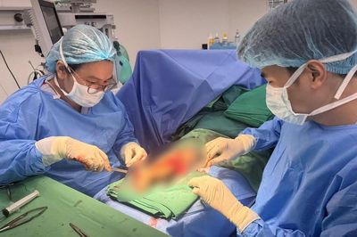 Suýt mất cả chân sau tai nạn giao thông, cô gái 21 tuổi được cứu bằng kỹ thuật lấy da từ da đầu