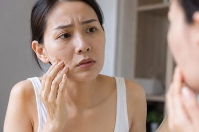 5 sai lầm khi giảm cân có thể đẩy nhanh lão hóa