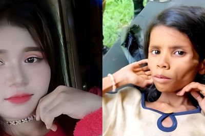 Bé gái mất tích 47 ngày trong rừng, gầy trơ xương khi được tìm thấy, giờ ra sao?