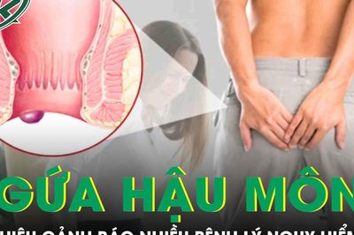 Ngứa hậu môn kéo dài có thể là dấu hiệu cảnh báo nhiều bệnh lý nguy hiểm