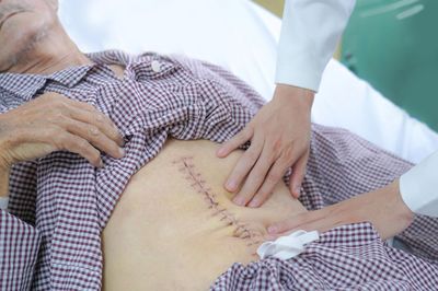 Bệnh nhân ở TP.HCM được cứu nhờ phát hiện 'bom hẹn giờ' trong bụng